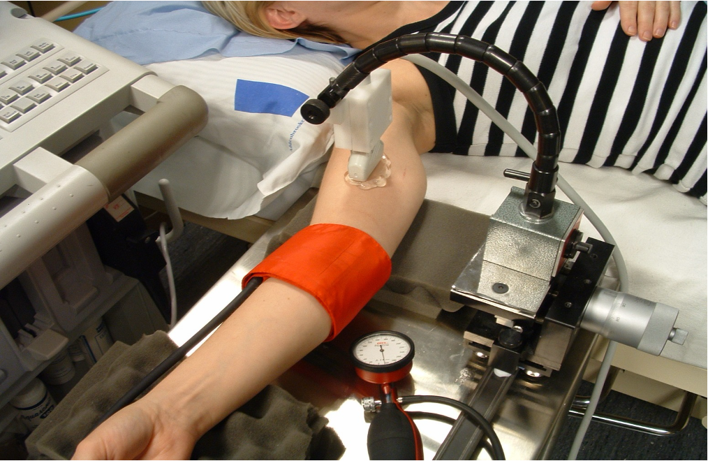 A participant’s arm supported on a foam wedge with a red upper-arm cuff inflated to suprasystolic pressure and a stereotactic-mounted linear ultrasound probe imaging the brachial artery during a flow-mediated dilatation measurement.